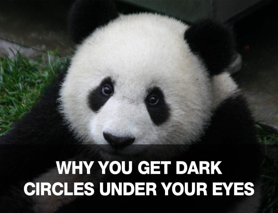 Why You Get Dark Circles Under Your Eyes